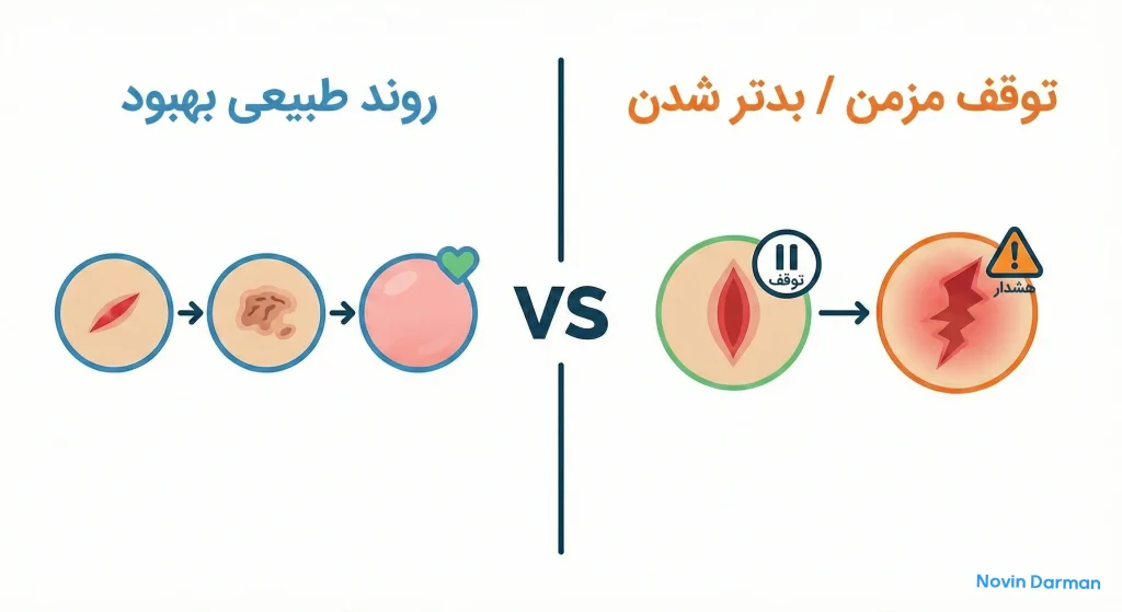 توقف ترمیم زخم و تبدیل آن به زخم مزمن