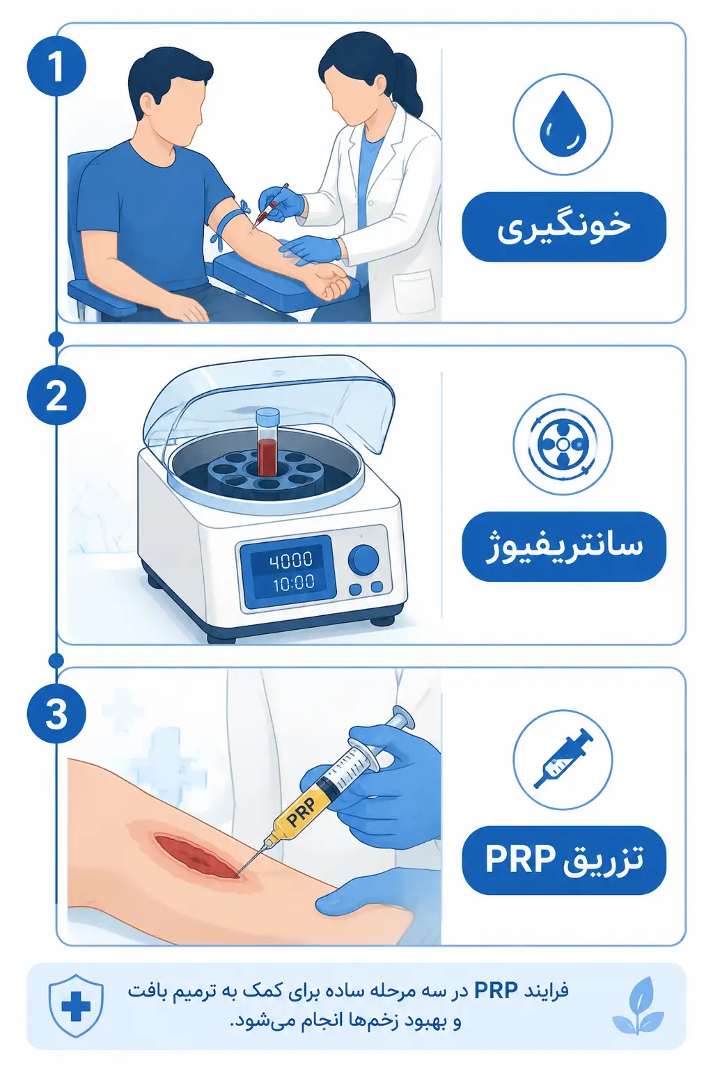 مراحل انجام پی آر پی زخم