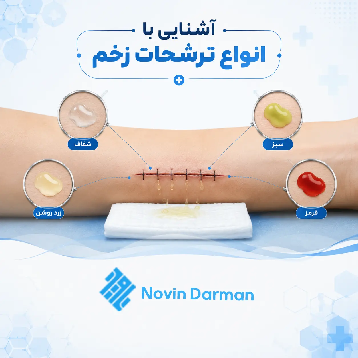 معنی و تفاوت انواع ترشحات زخم