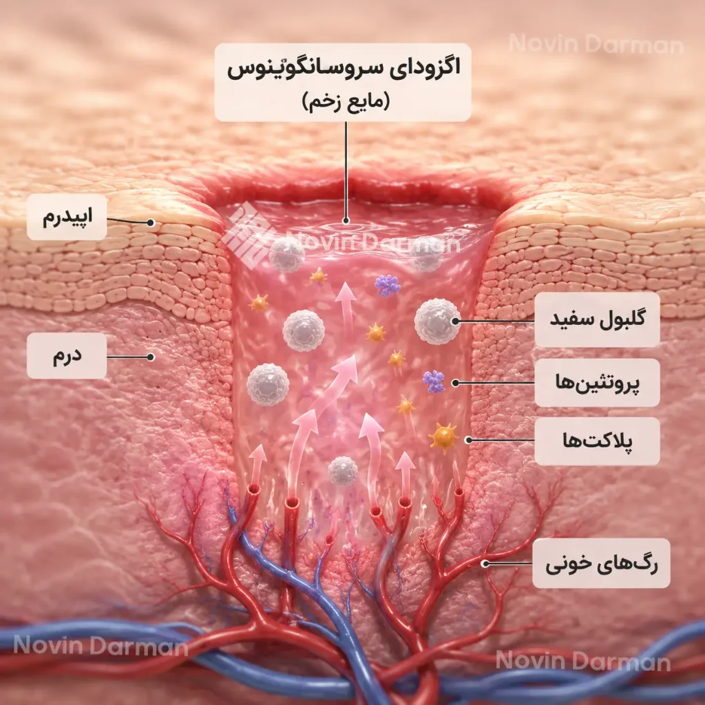 نقش ترشحات سروزی در فرایند ترمیم زخم 