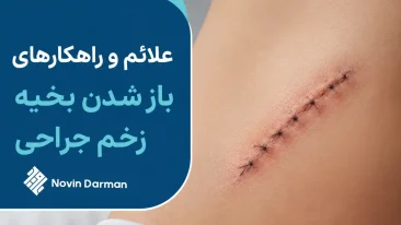 باز شدن بخیه زخم جراحی