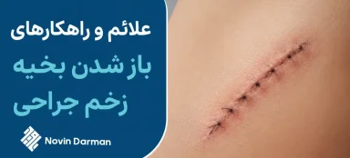باز شدن بخیه زخم جراحی